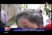 Cajamarca: hombre ataca a su expareja mordiéndole la cara