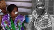 भैया-भाभी के साथ मिलकर पति ने किया जुल्म, बीवी की काट ली नाक