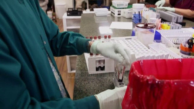 Zbulimi i tumorit, së shpejti përmes një analize gjaku - Top Channel Albania - News - Lajme