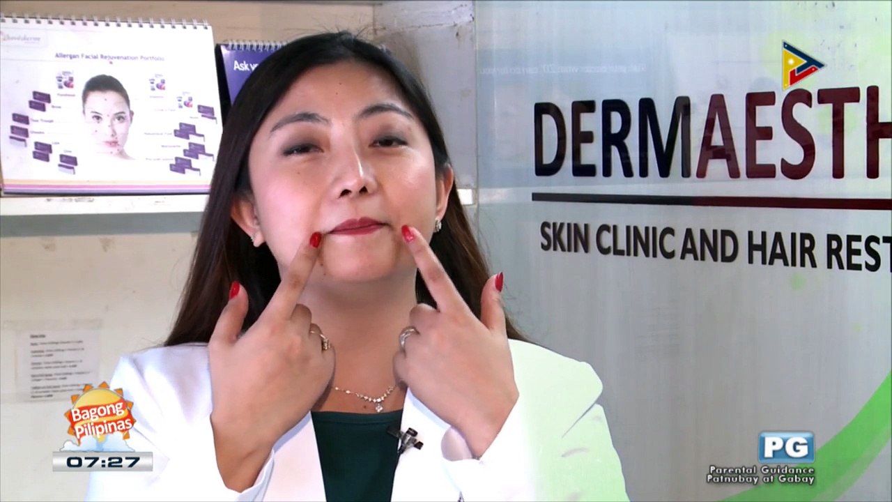 DERMAESTHETIQUE: Nasolabial fold treatment using platelet rich plasma (PRP)