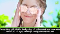 Những lúm đồng tiền gây thương nhớ nhất xứ sở kim chi