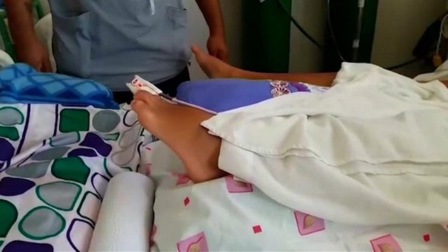 Perú descubre la posible causa del brote de Guillain-Barré