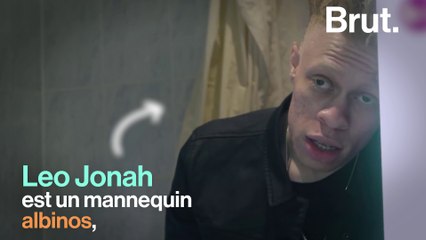 Leo Jonah, mannequin albinos