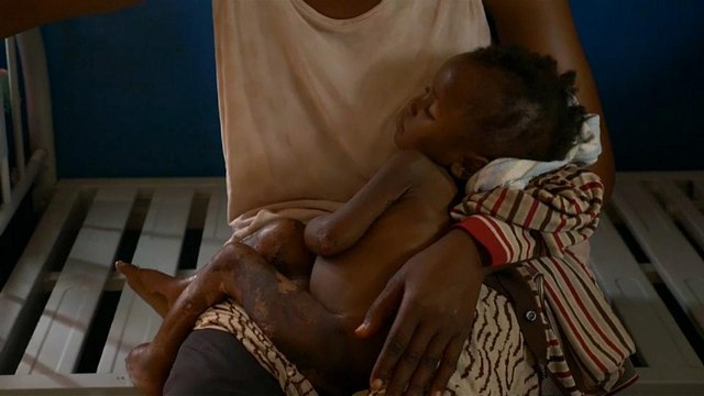 Детский гуманитарный кризис