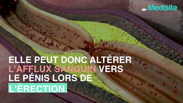 5 causes de troubles érectiles auxquelles vous n’avez pas pensé