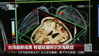 [中国新闻]台湾最新成果 有望延缓阿尔茨海默症 | CCTV-4