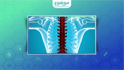 ما هو سبب تنميل الأطراف