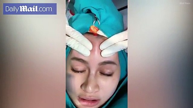 the most disgusting video you'll ever watch