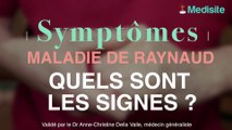 Maladie de Raynaud : quels sont les signes ?