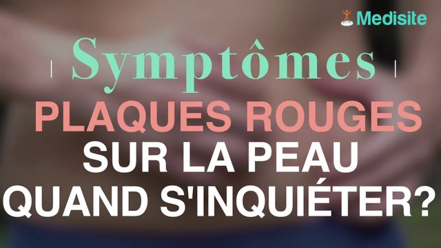 Plaques rouges sur la peau : quand s’inquiéter ?