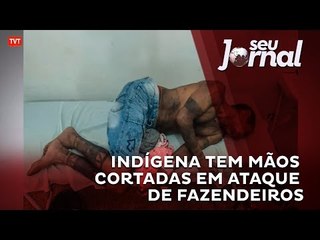 Indígena Gamela tem as mãos cortadas com facão em ataque de fazendeiros