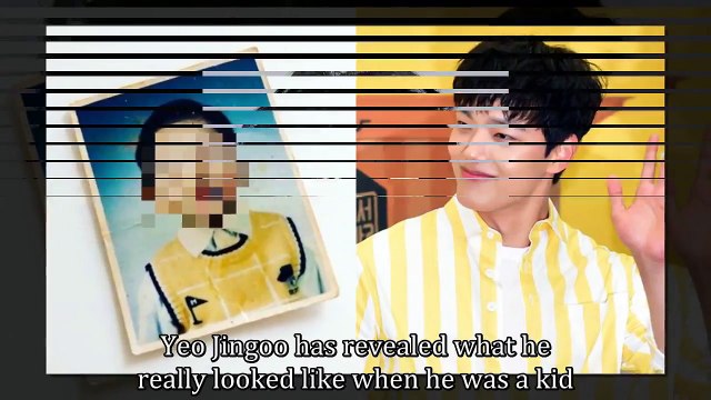 Actor Yeo Jingoo Shares His Childhood Photo... We Know He has Been This Adorable Since He was Born