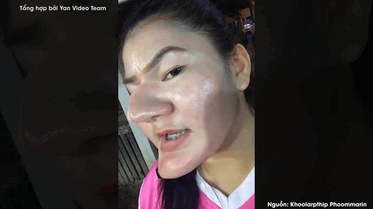 Cô gái có gương mặt phù thủy do phẫu thuật thẩm mĩ hỏng