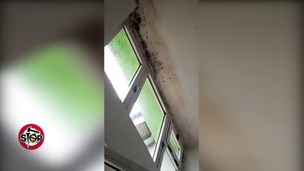 Stop - Kirurgjia-QSUT...aty ku mund të vdesësh nga myku ..rroftë shëndetësia e Rilindur!!!