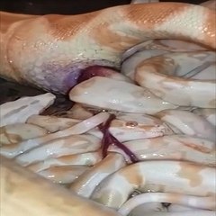 Tüyler Ürperten Doğurma Anı!