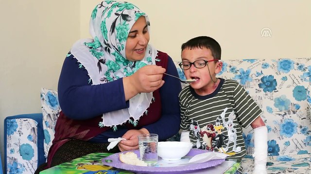 EVLADA ADANAN ÖMÜRLER - Kelebek hastası evladına sarılmanın özlemini çekiyor - DİYARBAKIR
