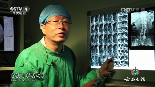 《中华医药》 20160914 健康故事：针尖上的手术 | CCTV-4