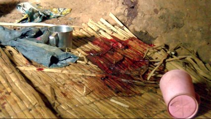 'Real carnage': Dozens killed in attack on Burundi border village