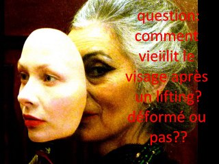 lifting du visage  comment ça vieillit, par vladimir mitz