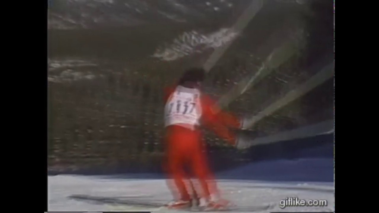 Comment je me suis cassé la jambe [Histoire vrai]