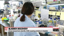 S. Korean researchers find protein that causes OAB