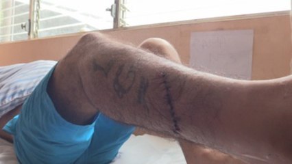 Nuevos enfrentamientos en Nicaragua dejan otros 6 heridos de bala