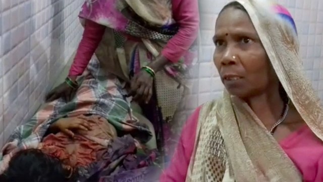 सीतापुर के बाद मुरादाबाद में कुत्ते ने तीन मासूमों को बुरी तरह नोंच डाला