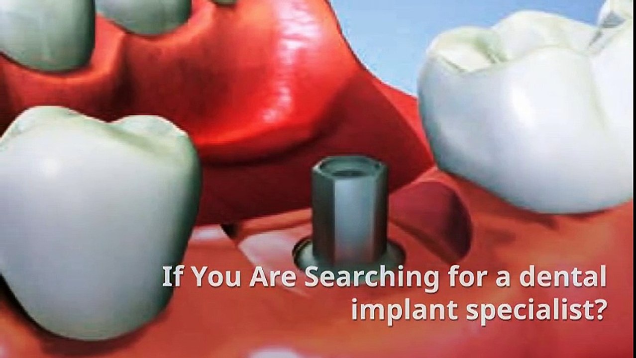 Get dental implants From Our Speciliast - Cosmetic Family Dentistry of Pearland -Dr. Amit Jethva