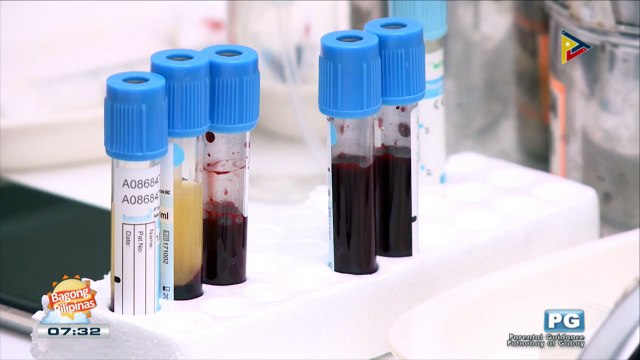 DERMAESTHETIC: Deep and under eye treatment using platelet rich plasma(PRP)