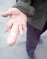 Ce gros doigt de cet homme ressemble à un  pénis