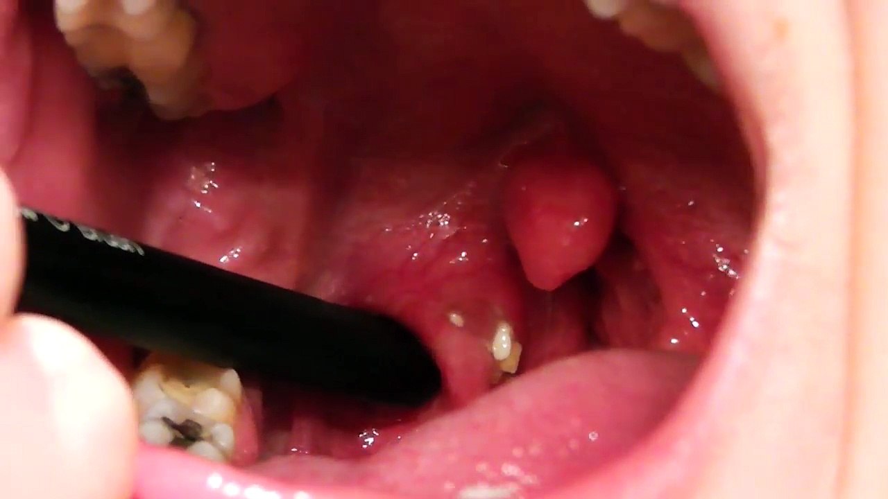 J’ai enlevé ceci de ma bouche et retrouver enfin une bonne haleine