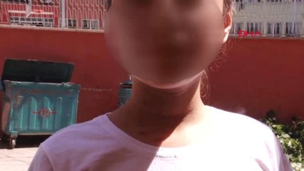 Gaziantep 13 Yaşındaki Kızı Dövüldüğü İddiasıyla Şikayetçi Oldu-