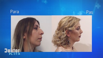 Doktor Plastik mundesuar nga klinika "Da Vinci" - Historia e Diostela Koljaka (19 maj 2018)