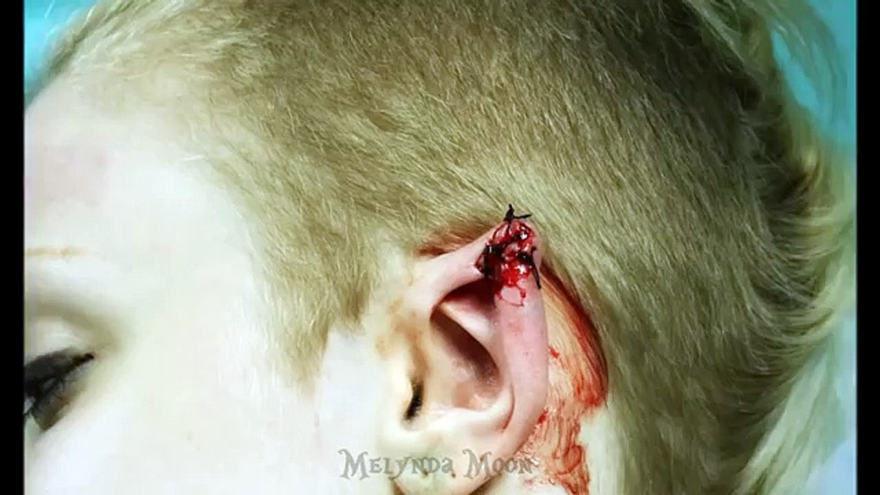 My Elf Ear Modification
