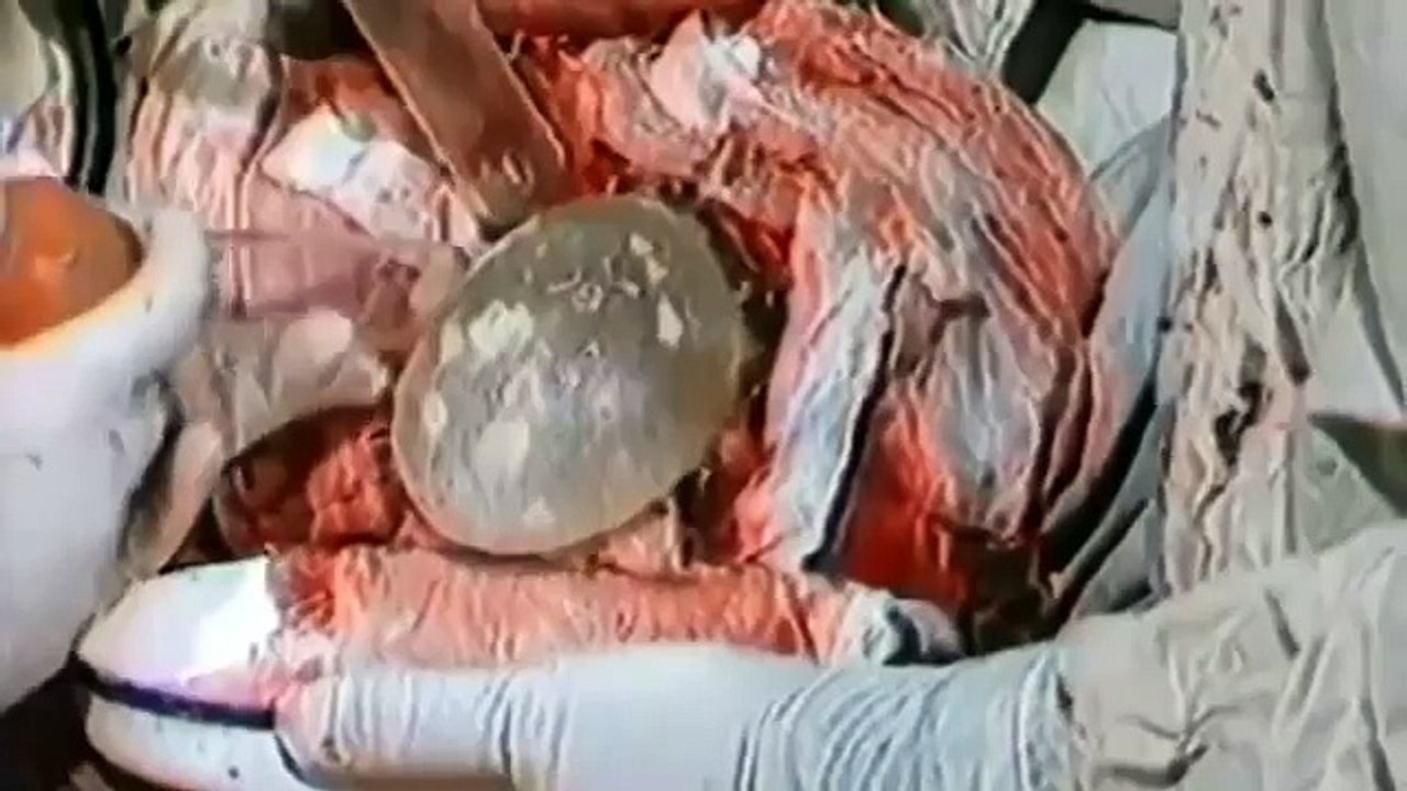 National Geographic 2017 - Parasites Eating Us Alive Full Documentary 2016 720p - Documenatry & Dis