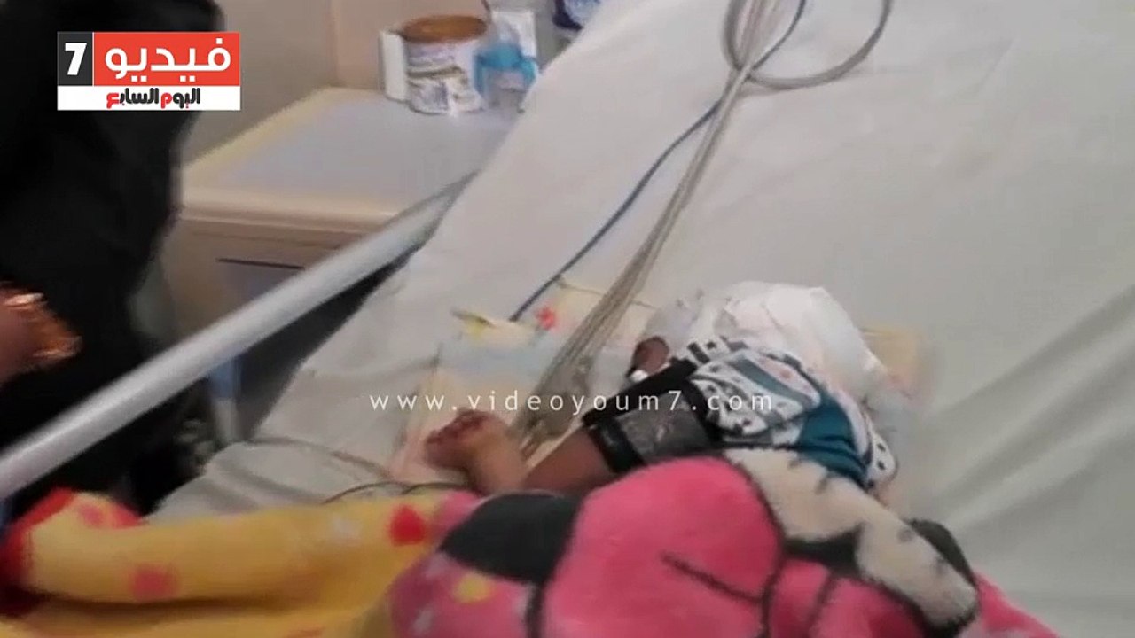 محافظ الغربية يطمئن على الطفل زياد محمد بعد استخراج سيخ حديدى من رأسه