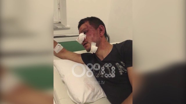 Ora News - I arrestuari për sulmin me armë përfundon në spital, familjarët: U dhunua nga policia