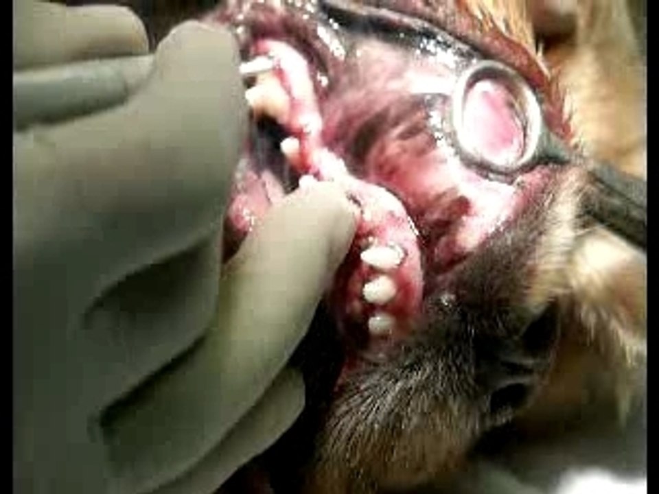 Gingivectomie