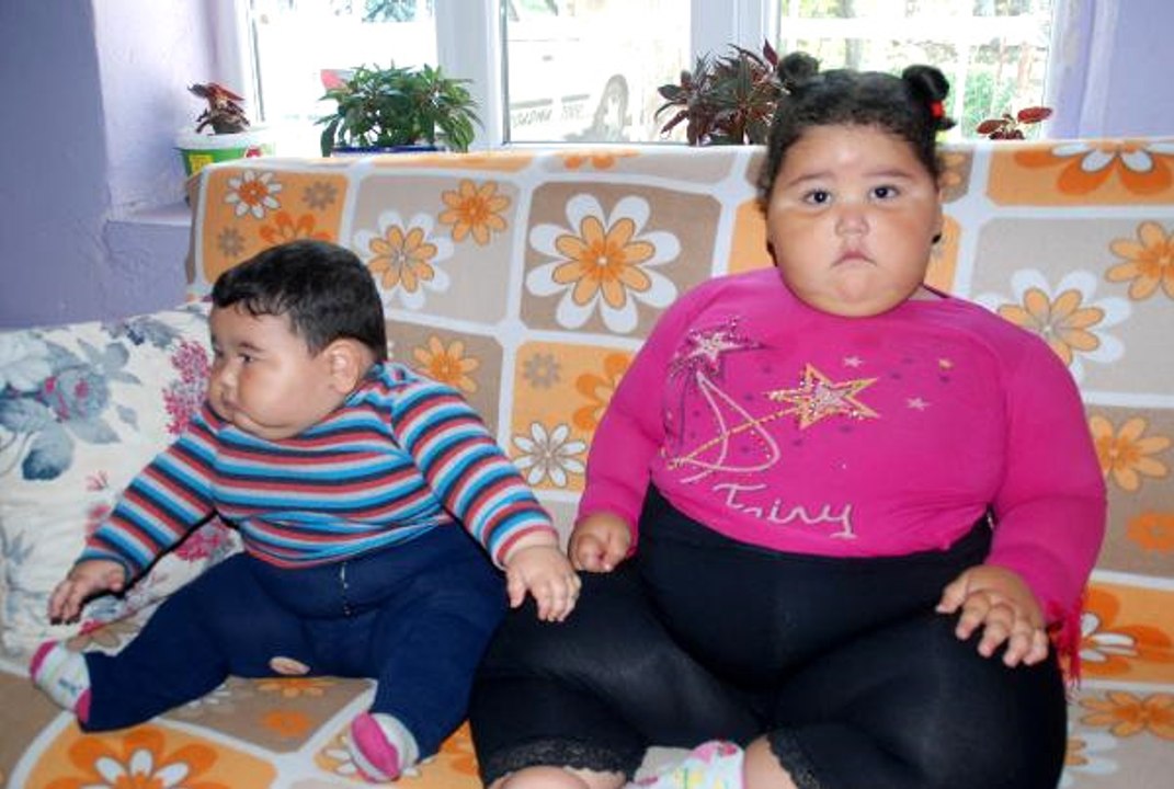 2,5 Yaşındaki 55, 9 Aylık Kardeşi  25 Kilo! Teşhis Konulamayan Kardeşlerin Yardım Çığlığı