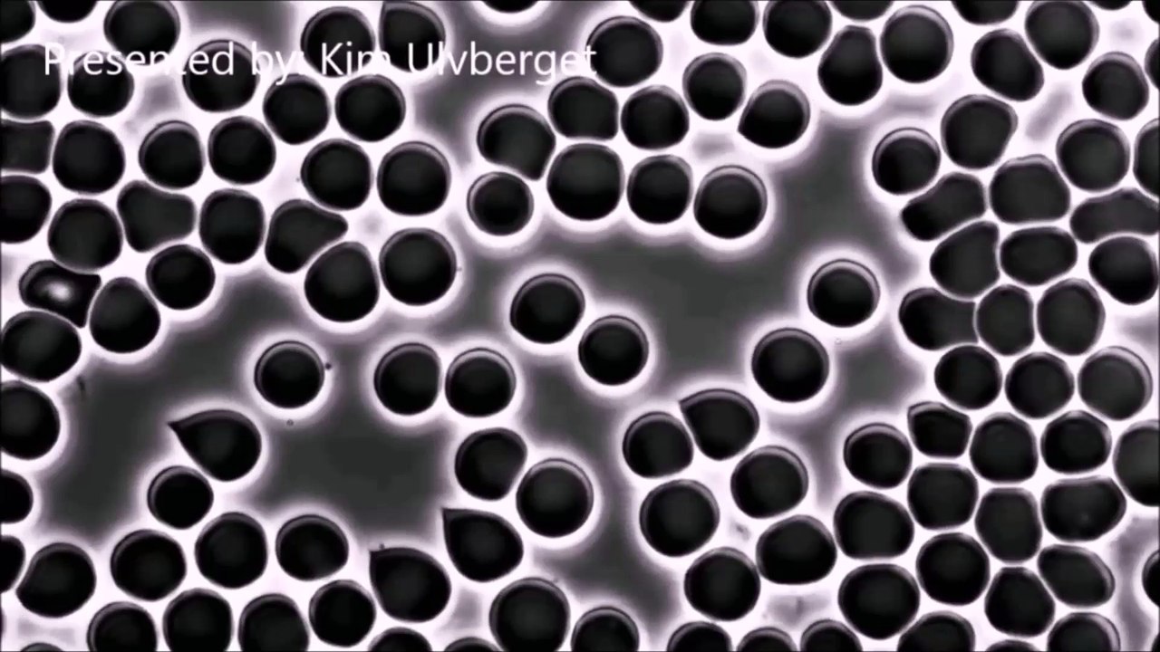 Live Blood Analysis What`s in Your Blood? Microscopy