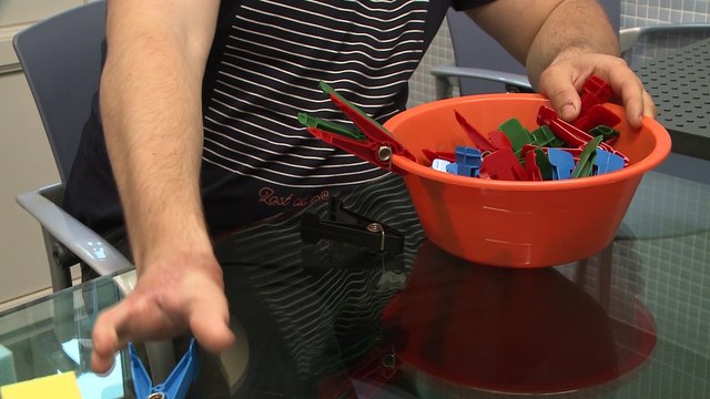 Vida normal después de trasplantar dedos del pie a la mano