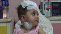 İzmir Ablasının Fırlattığı Çatal, 9 Aylık Bebeğin Başına Saplandı