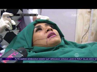 Cut Memey Lakukan Perawatan Wajah