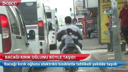 Bacağı kırık oğlunu böyle taşıdı