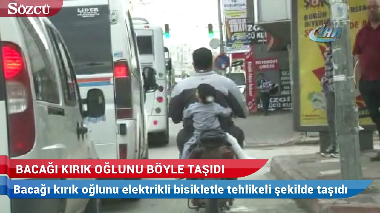 Bacağı kırık oğlunu böyle taşıdı