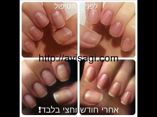 טיפול בפטרת ציפורניים