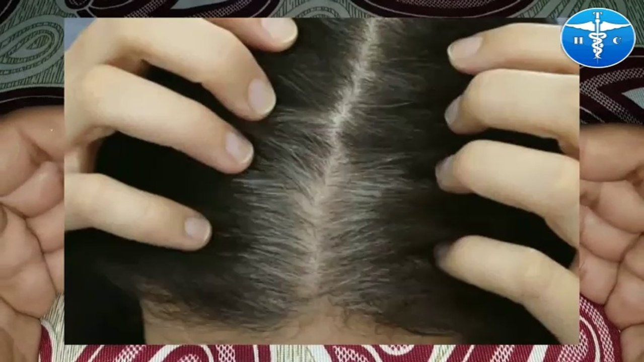 सिर्फ 20 मिनट में सफेद बालों को काला होते देखिए !