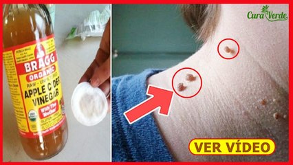 Remedio MÁGICO Contra INSÔNIA ➜ Coloque Embaixo da Língua e DURMA em Minutos...