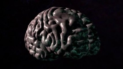 Israeli Research Targets Lissencephaly