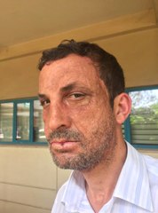 İlk Yüz Nakilli Uğur Acar'ın Saçları Siyah, Sakalları Beyaz Çıkıyor